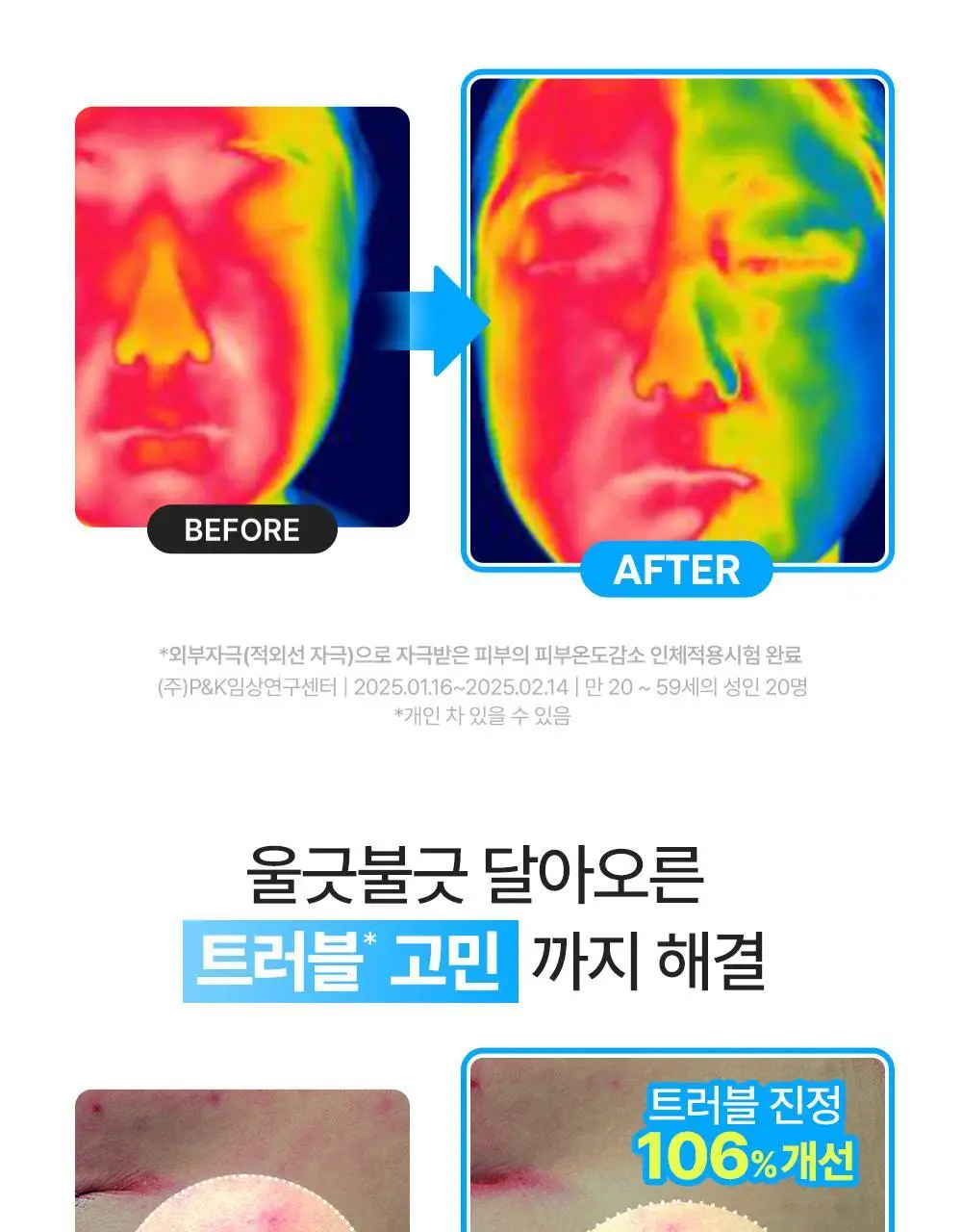 [NEW/열감쿨링] 닥터지 레드 블레미쉬 순무 시카 아이싱 패드 60매 리필 기획 (+60매 리필) 상세페이지 14